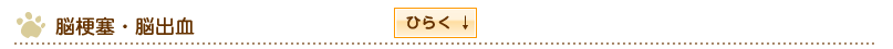 脳梗塞・脳出血