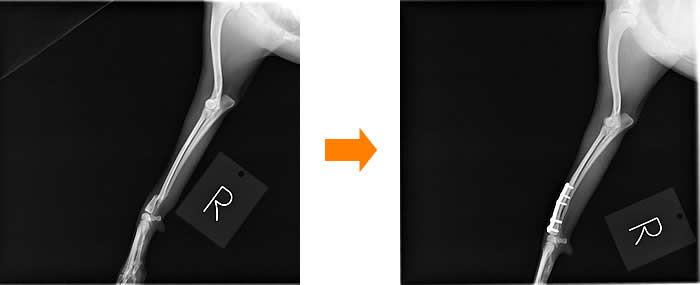 橈尺骨骨折治療