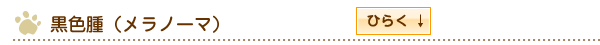 黒色腫（メラノーマ）
