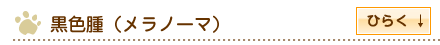 黒色腫（メラノーマ）